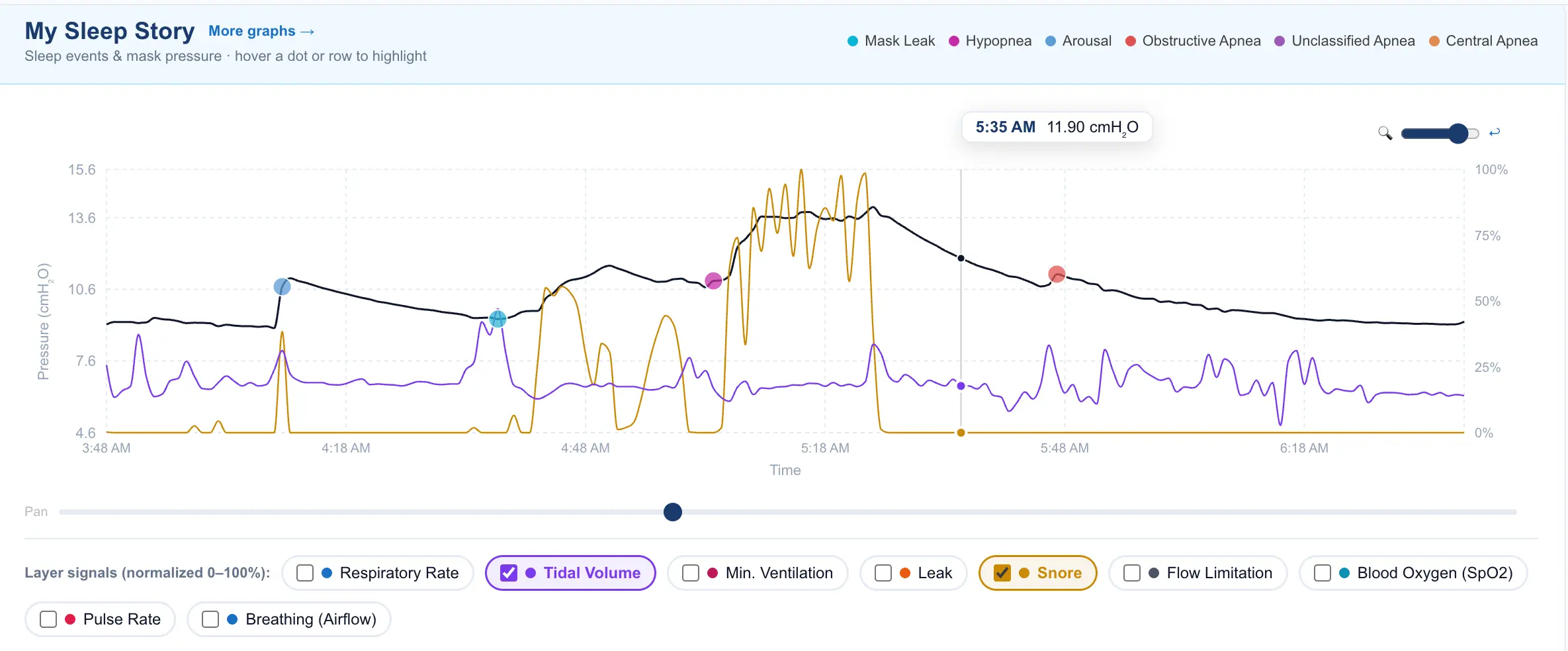 Layered CPAP signals showing flow, tidal volume, and respiratory patterns across a night